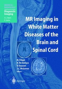 bokomslag MR Imaging in White Matter Diseases of the Brain and Spinal Cord