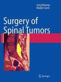 bokomslag Surgery of Spinal Tumors