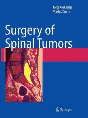 bokomslag Surgery of Spinal Tumors