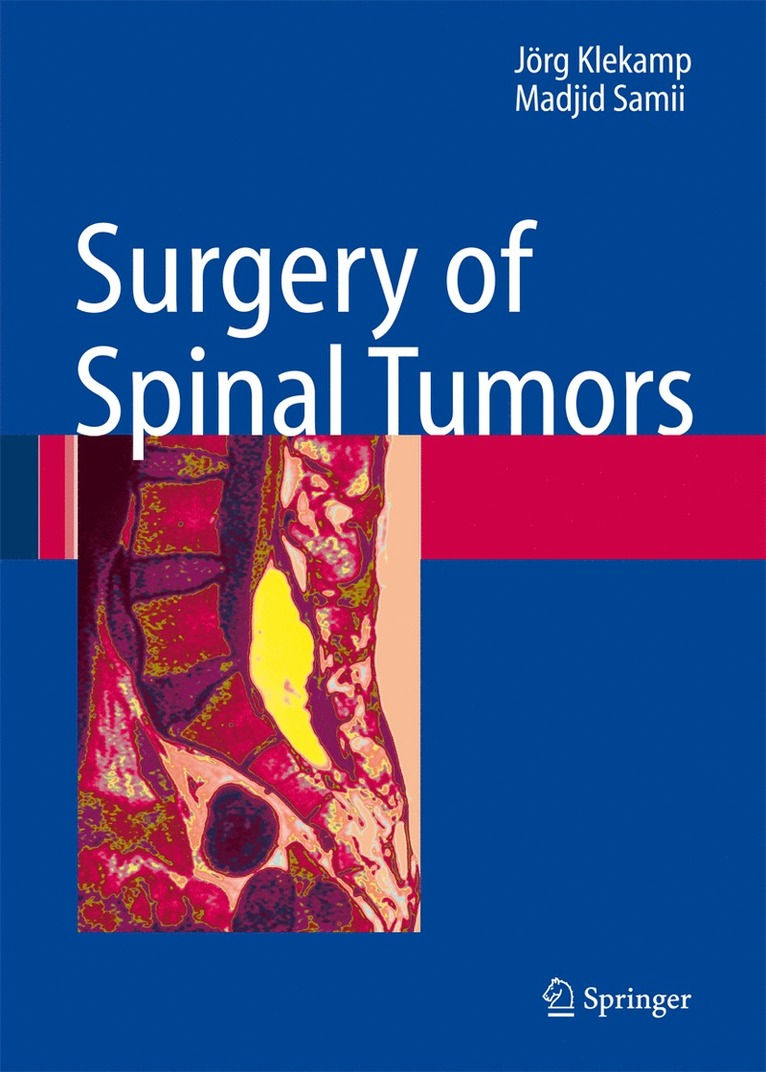 Surgery of Spinal Tumors 1