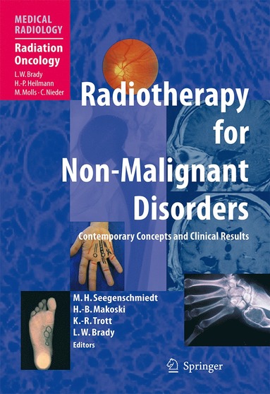 bokomslag Radiotherapy for Non-Malignant Disorders