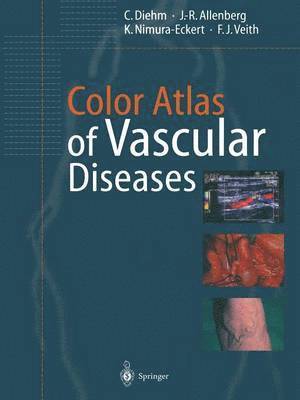 Color Atlas of Vascular Diseases 1