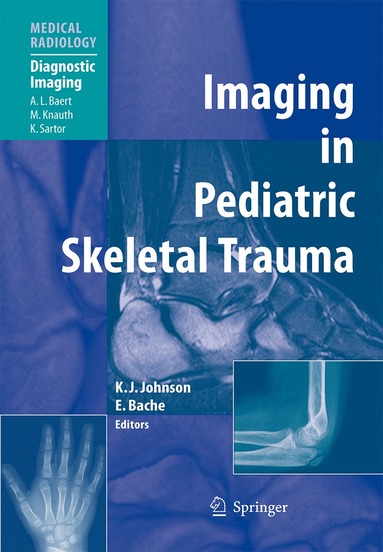 bokomslag Imaging in Pediatric Skeletal Trauma