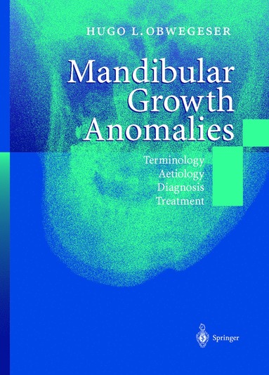 bokomslag Mandibular Growth Anomalies