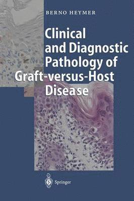 bokomslag Clinical and Diagnostic Pathology of Graft-versus-Host Disease