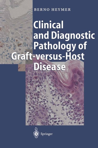 bokomslag Clinical and Diagnostic Pathology of Graft-versus-Host Disease