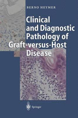 Berno Heymer - Clinical and Diagnostic Pathology of Graft-versus-Host Disease, Häftad