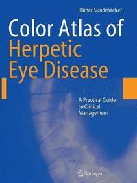 bokomslag Color Atlas of Herpetic Eye Disease