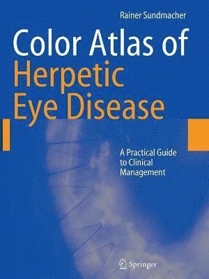 Color Atlas of Herpetic Eye Disease 1