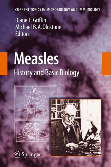 bokomslag Measles