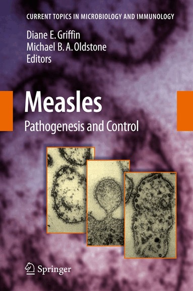 Diane E. Griffin, Michael B. A. Oldstone - Measles, Häftad