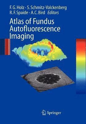 Atlas of Fundus Autofluorescence Imaging 1