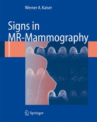 bokomslag Signs in MR-Mammography