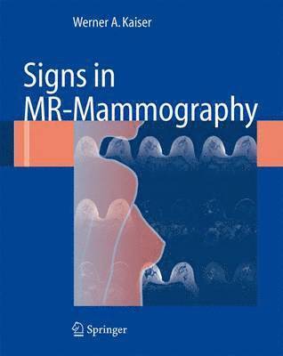 Signs in MR-Mammography 1