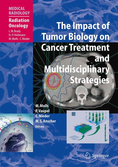 Michael Molls, Peter Vaupel, Carsten Nieder, Mitchell Steven Anscher - Impact of Tumor Biology on Cancer Treatment and Multidisciplinary Strategies, Häftad