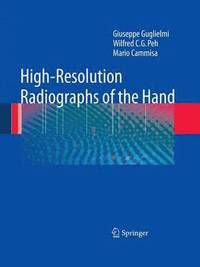 bokomslag High-Resolution Radiographs of the Hand