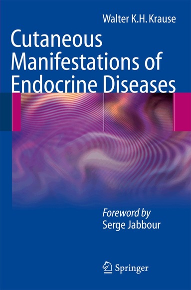Walter K.H. Krause - Cutaneous Manifestations of Endocrine Diseases, Häftad