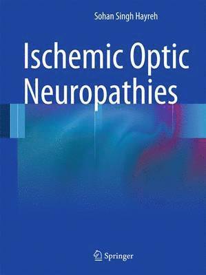 bokomslag Ischemic Optic Neuropathies