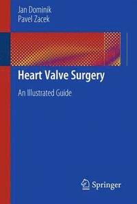 bokomslag Heart Valve Surgery