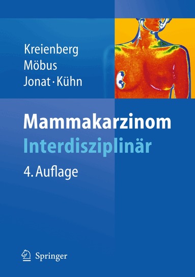 Rolf Kreienberg, Volker Möbus, Walter Jonat, Thorsten Kühn - Mammakarzinom, Inbunden