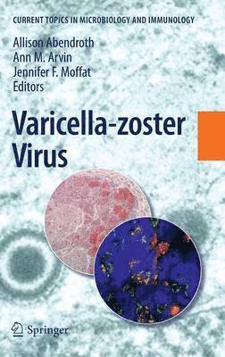 bokomslag Varicella-zoster Virus