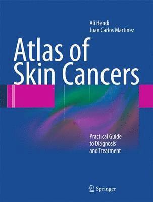 Atlas of Skin Cancers 1