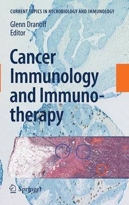 Cancer Immunology and Immunotherapy 1