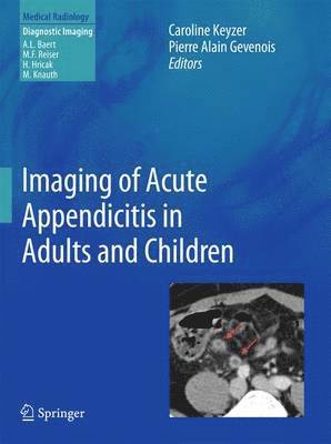 bokomslag Imaging of Acute Appendicitis in Adults and Children