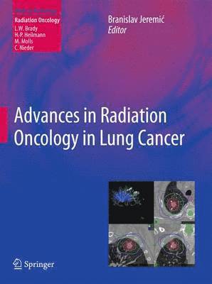 Advances in Radiation Oncology in Lung Cancer