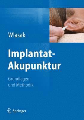 bokomslag Implantat-Akupunktur