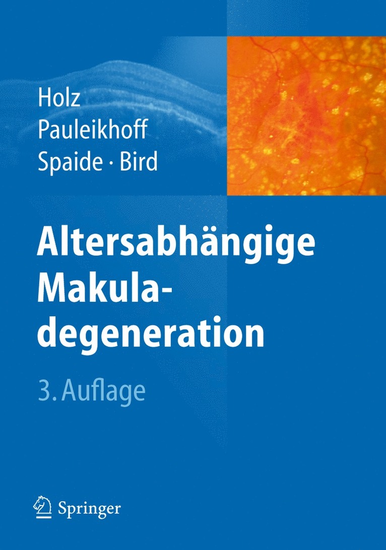 Frank G. Holz, Daniel Pauleikhoff, R.F. Spaide, A.C. Bird, A. C. Bird, R. F. Spaide - Altersabhängige Makuladegeneration, Inbunden