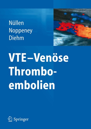 Helmut Nüllen, Thomas Noppeney, Curt Diehm - VTE - Venöse Thromboembolien, Inbunden