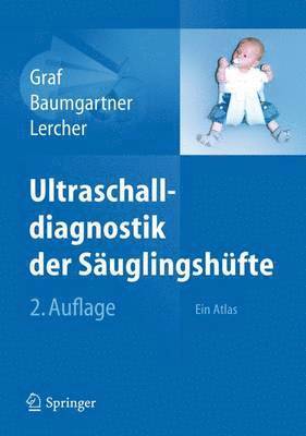 Ultraschalldiagnostik der Suglingshfte 1