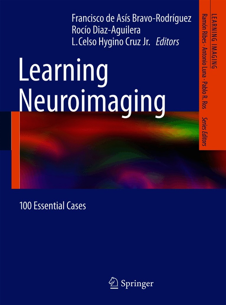 Learning Neuroimaging