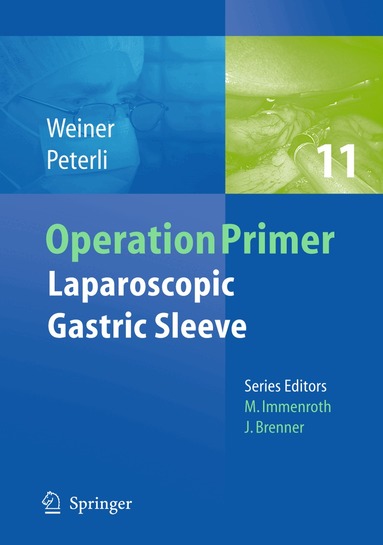 Rudolf A. Weiner, Ralph Peterli - Laparoscopic Gastric Sleeve, Häftad
