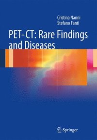 bokomslag PET-CT: Rare Findings and Diseases