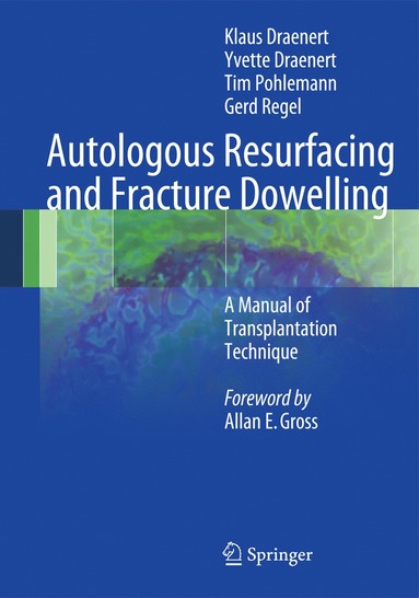 bokomslag Autologous Resurfacing and Fracture Dowelling