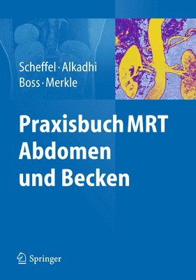 bokomslag Praxisbuch MRT Abdomen und Becken