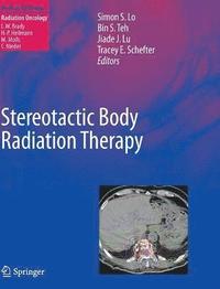 bokomslag Stereotactic Body Radiation Therapy