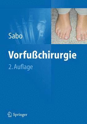 bokomslag Vorfußchirurgie