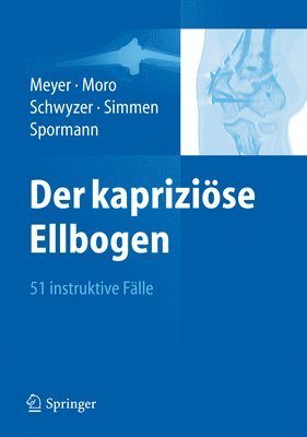 bokomslag Der kapriziöse Ellbogen
