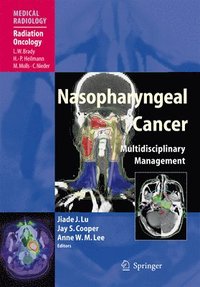 bokomslag Nasopharyngeal Cancer