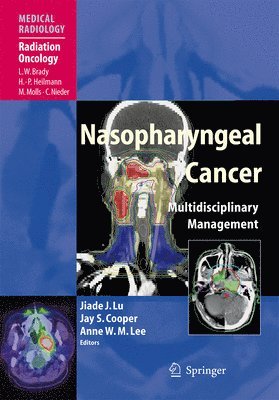 Nasopharyngeal Cancer 1