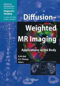 bokomslag Diffusion-Weighted MR Imaging