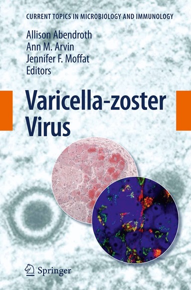 Allison Abendroth, Ann M. Arvin, Jennifer F. Moffat - Varicella-zoster Virus, Häftad