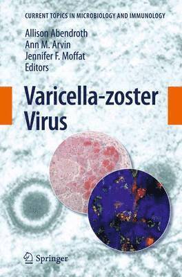 bokomslag Varicella-zoster Virus