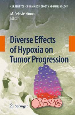 bokomslag Diverse Effects of Hypoxia on Tumor Progression