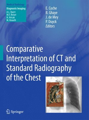 bokomslag Comparative Interpretation of CT and Standard Radiography of the Chest