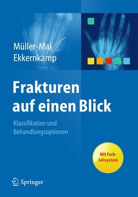 Christian Müller-Mai, Axel Ekkernkamp, Christian Muller-Mai - Frakturen auf einen Blick, Häftad