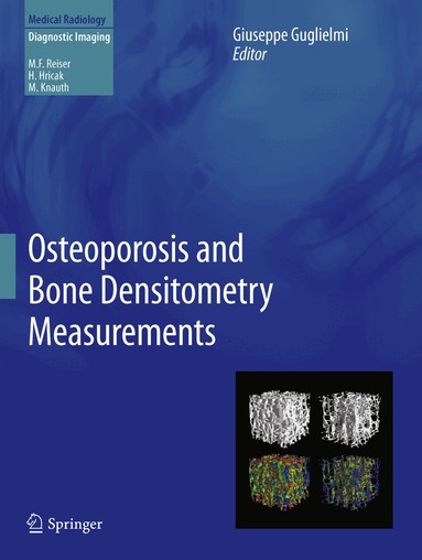 Giuseppe Guglielmi - Osteoporosis and Bone Densitometry Measurements, Inbunden